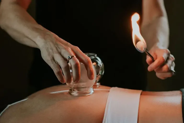 Cupping therapy
